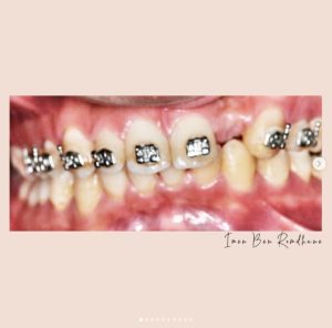 dentiste 1