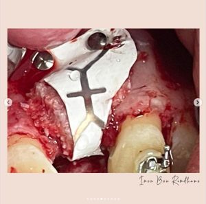 dentiste 5