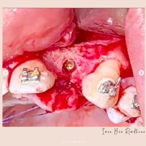 dentiste 6