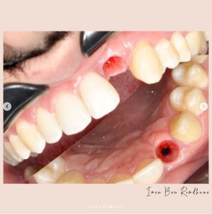 dentiste 7